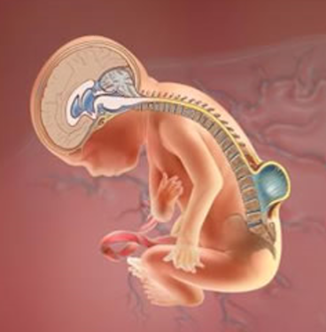 Spina Bifida nedir?